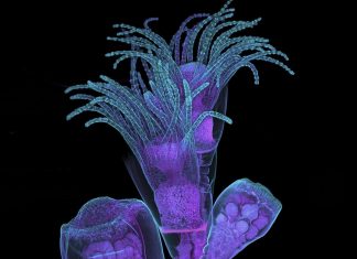 Salute, malattie del rene nei bambini: scoperte basi genetiche