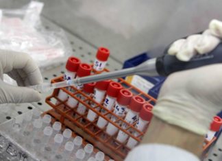 Coronavirus, gli scienziati israeliani al lavoro per preparare il vaccino. Il ministro Akunis: pronto in poche settimane