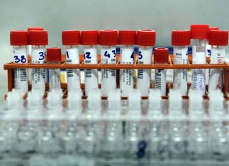 Coronavirus, l’Islanda dichiara lo stato di emergenza: 45 contagiati