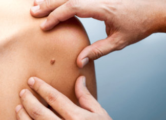 Genova, morta per un intervento a un neo: arrestati medico e ‘santone’