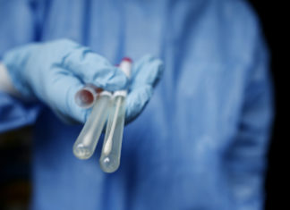 Vaccini, Unità crisi Campania: “Dubbi sui rischi per il mix, caos per la terza dose”