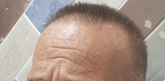 Napoli Est, spari in strada: gambizzato 62enne