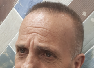 Napoli Est, spari in strada: gambizzato 62enne Napoli Est, spari in strada: gambizzato 62enne