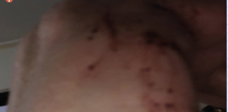 Caserta, emergenza violenza: due donne picchiate in meno di 48 ore