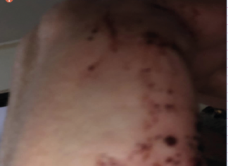 Caserta, emergenza violenza: due donne picchiate in meno di 48 ore Caserta, emergenza violenza: due donne picchiate in meno di 48 ore