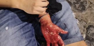 Napoli, reagisce alla rapina e viene accoltellato