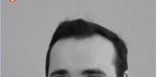 Giugliano, auto contro scooter: muore un 29enne