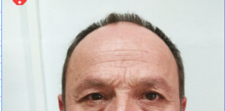 Latitante dopo la condanna, catturato il ras del clan Polverino