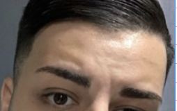 Napoli, gambizzato un 20enne