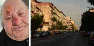 Secondigliano, sulla sinistra l'uomo pestato a sangue da una baby gang