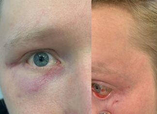 Tre fratelli pestati e rapinati da dieci uomini vicino la stazione di Napoli. LE FOTO