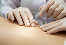 Filler e botulino: guida ai trattamenti sicuri Sicurezza estetica