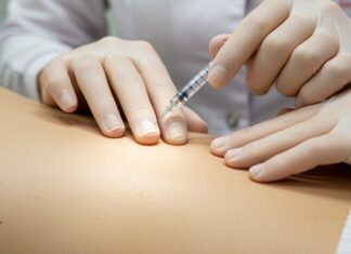 Filler e botulino: guida ai trattamenti sicuri Sicurezza estetica