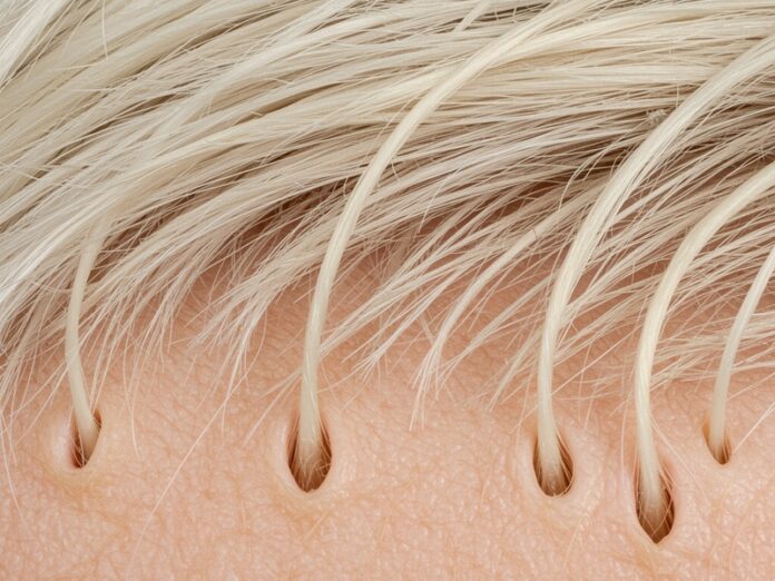 9_produzione_melanina Produzione melanina