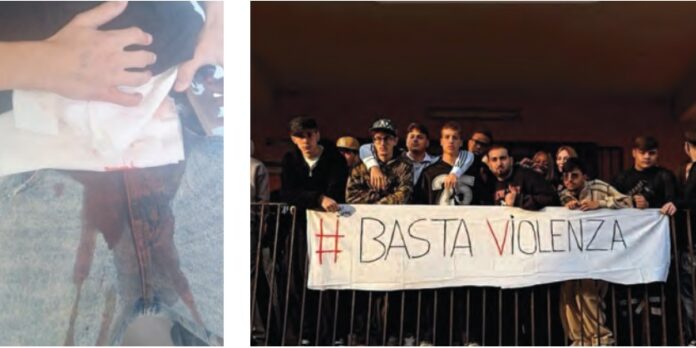 Studente accoltellato a Castel Volturno