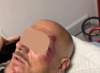 Pestato per difendere le figlie al Vomero: presidio delle mamme sabato
